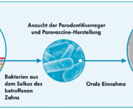 ParoVaccine Anregung des Immunsystems